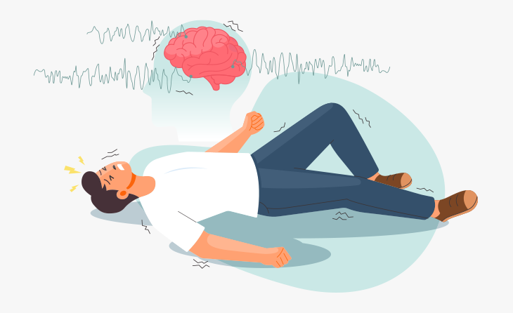 Sara Krizi (Epilepsi) Nedir?